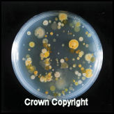Bacterial colonies on a petri dish. Marked Crown Copyright.